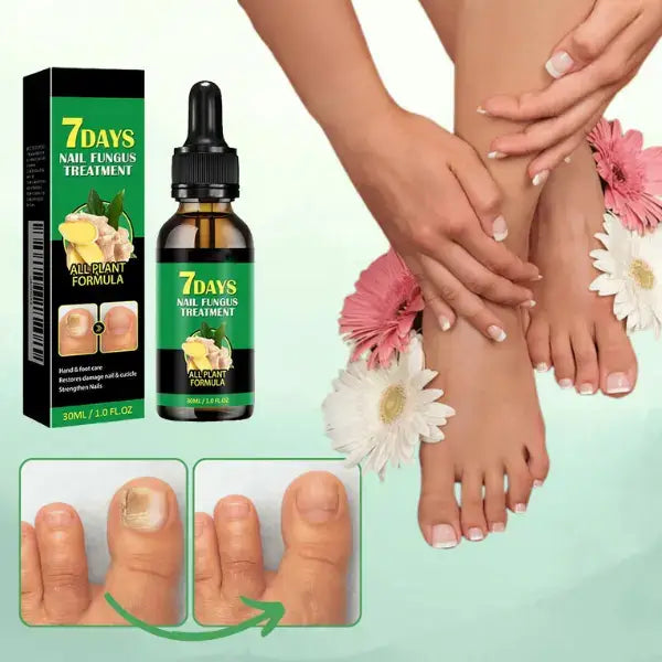 Tratamiento Natural Antifúngico en 7 Días