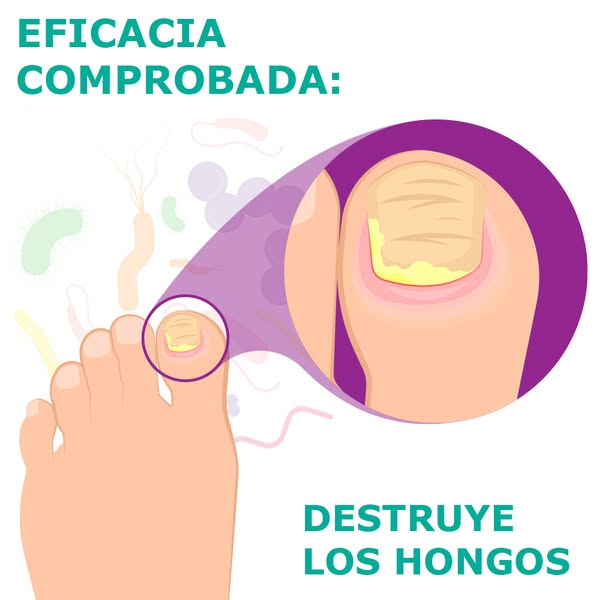 Tratamiento Natural Antifúngico en 7 Días